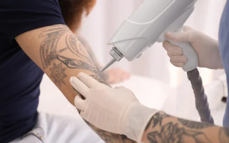 Seasonal considerations for scheduling tattoo removal