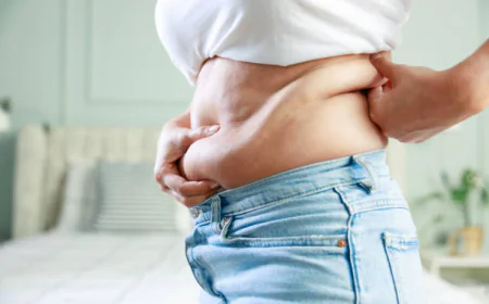 Tummy Tuck Surgery Exercise Restrictions List