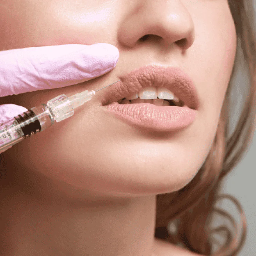 Lip Fillers Injections 101: Basics Every Beginner Should Know