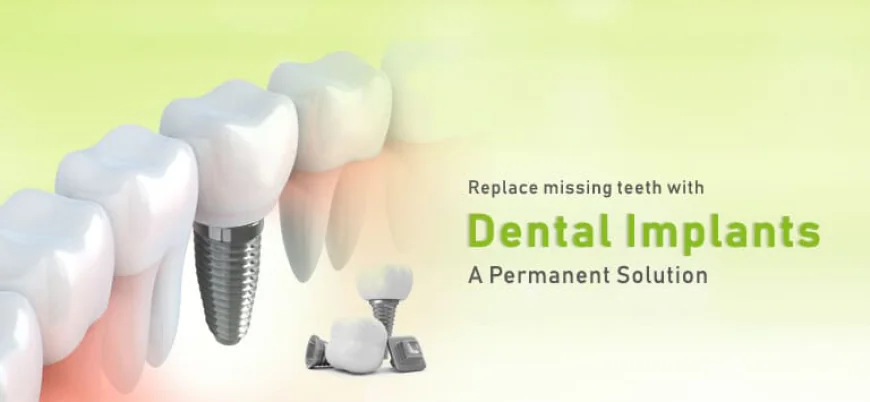 Is India Good for Dental Implants? A Complete Guide for Patients
