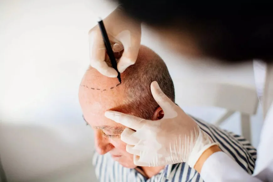 Is Scarless Hair Transplant in Dubai Truly Scar-Free?