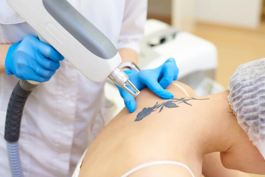 Tattoo Removal in Dubai: The Science Behind Permanent Results