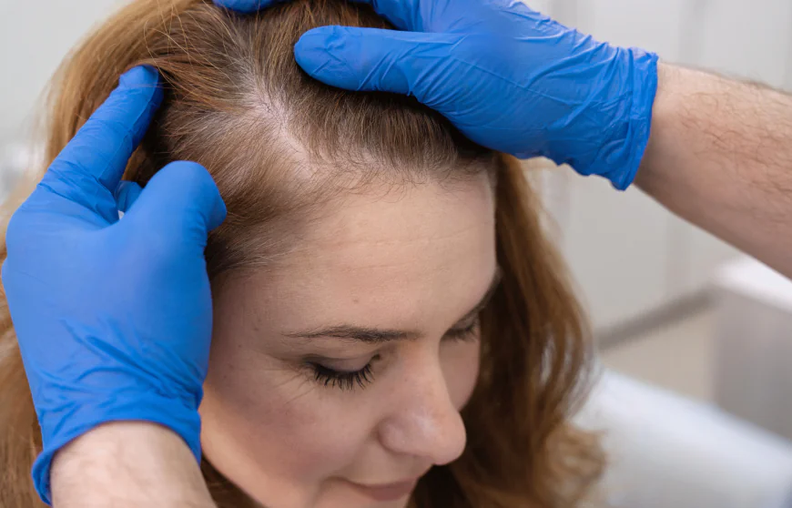 How Can GFC Hair Treatment Improve Overall Scalp Health and Vitality?
