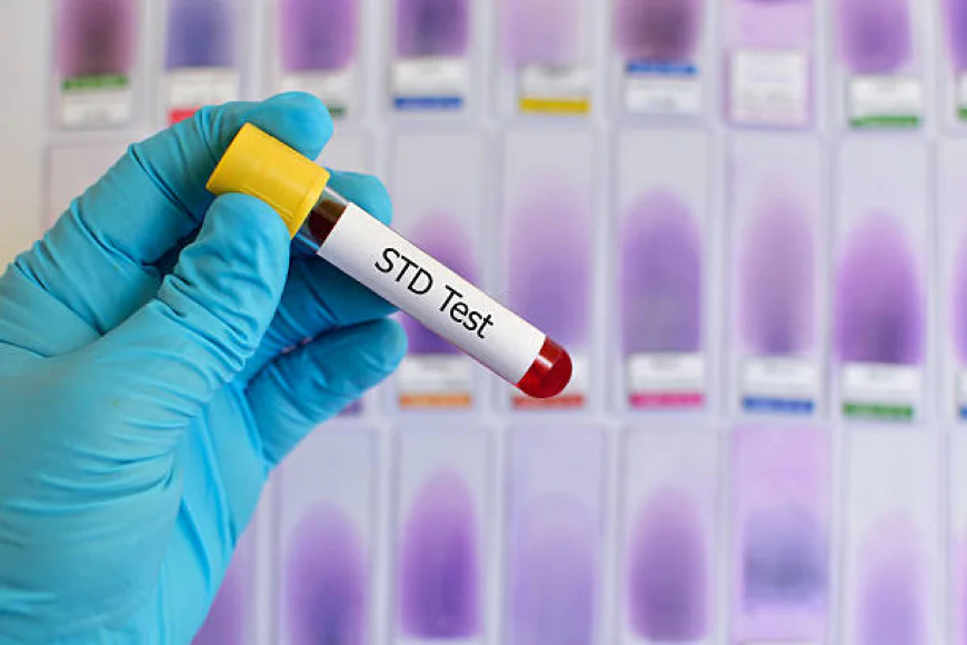 Get Accurate STD Test Results in Dubai Fast