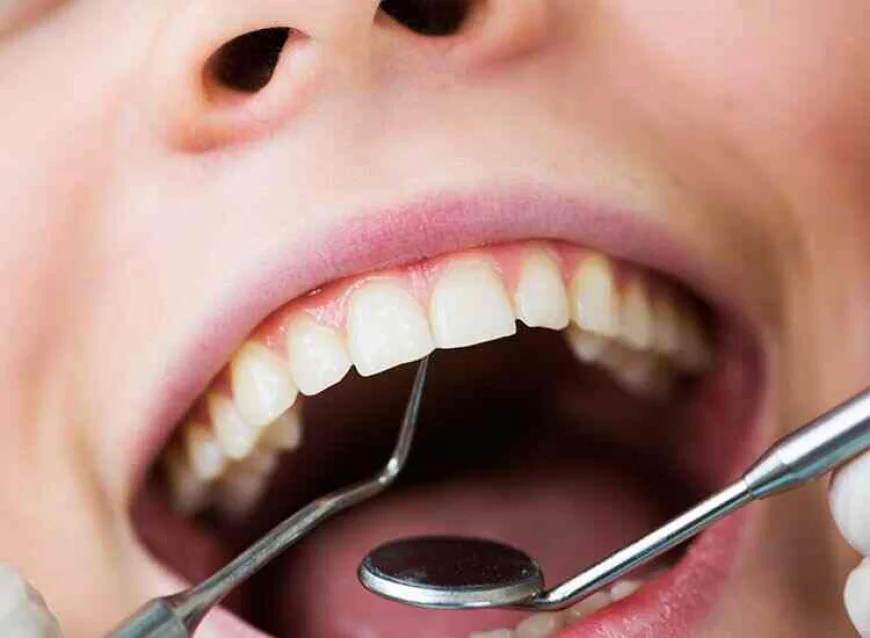 How Long Does Orthodontic Treatment Usually Take?