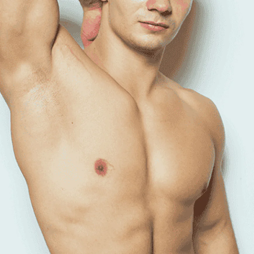 How to Talk to Friends and Family About Gynecomastia Surgery