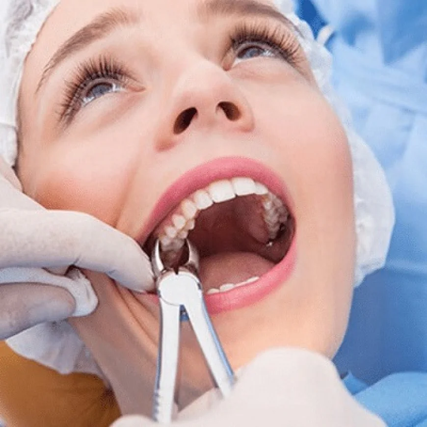 Teeth Extraction in Islamabad: Complete Patient Guide