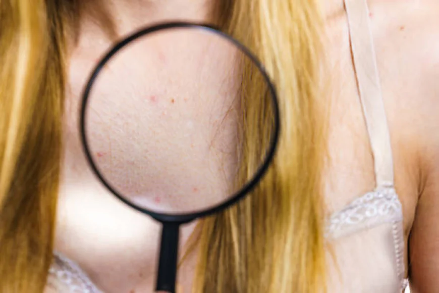 Skin Tag Removal and Skin Regeneration Process