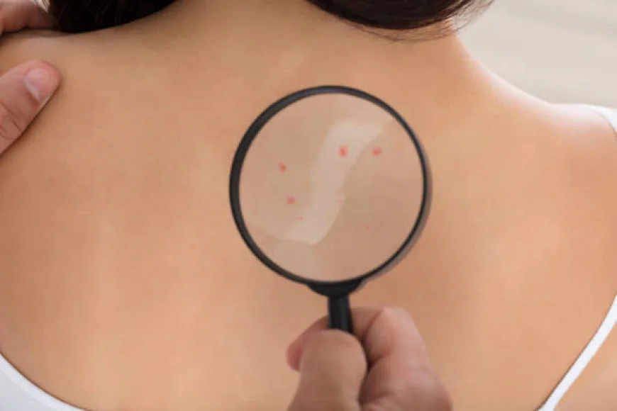 Skin Tag Removal: At-Home Vs. Professional Choices