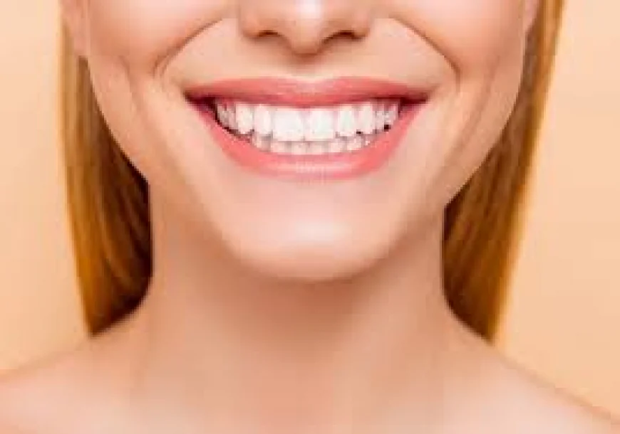 Is a Hollywood Smile Permanent? Everything You Need to Know