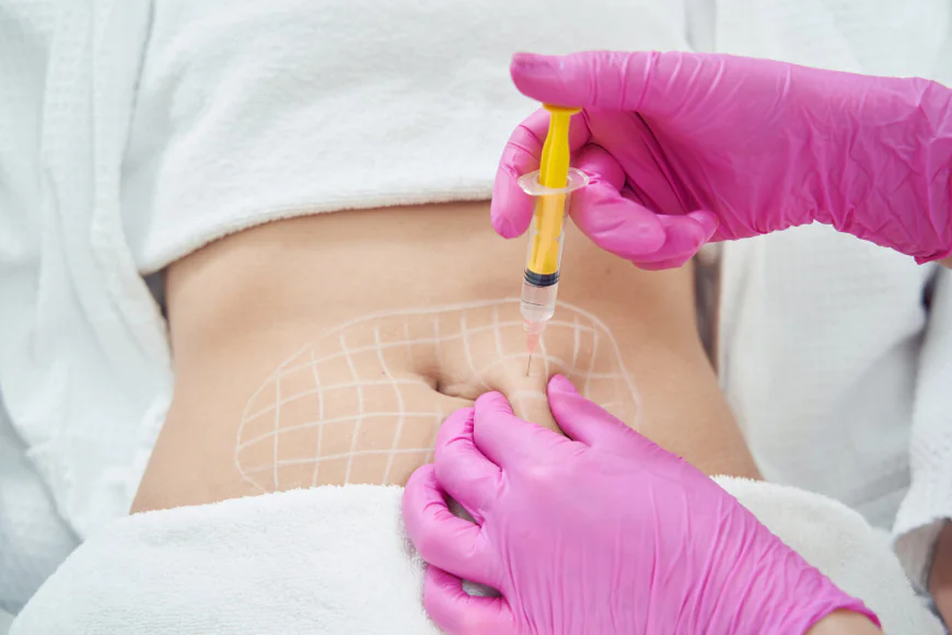 How Fat Melting Injections Boost Confidence in Riyadh