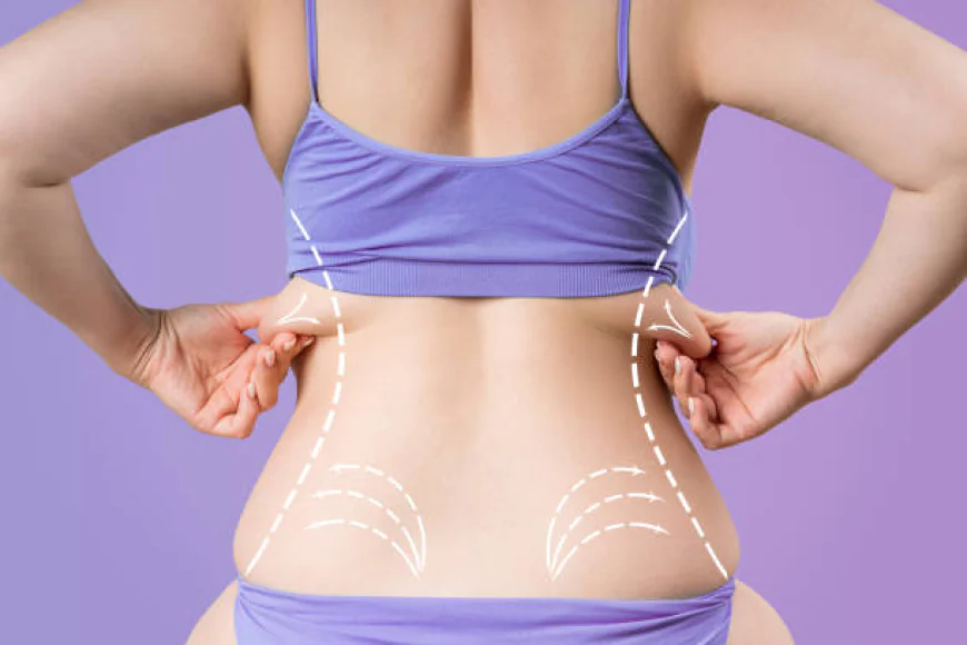 4D Vaser Liposuction Dubai: Boost Confidence Fast
