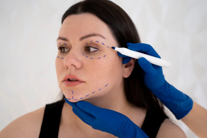 Thread Lift Secrets for Enhancing Cheek Prominence and Lower Face Structure