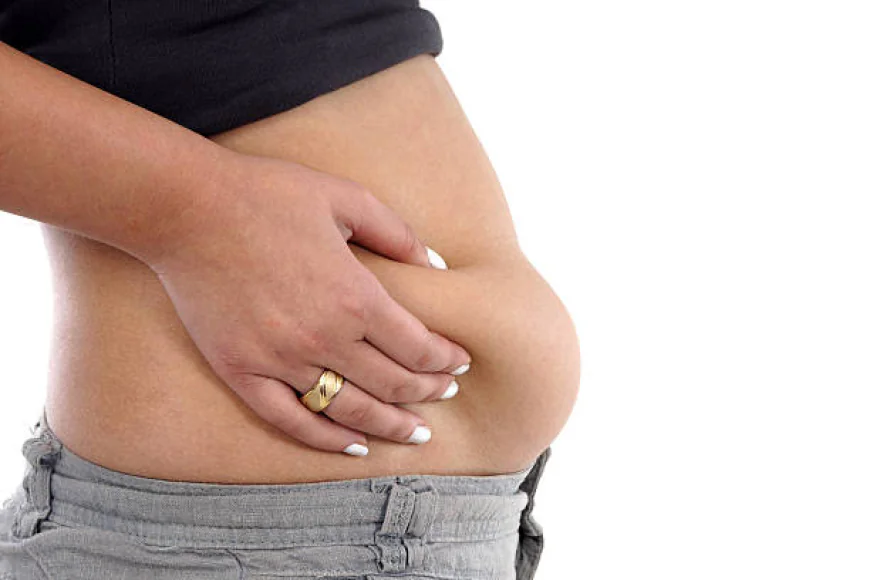 Tummy Tuck Surgery Myths Busted for Good