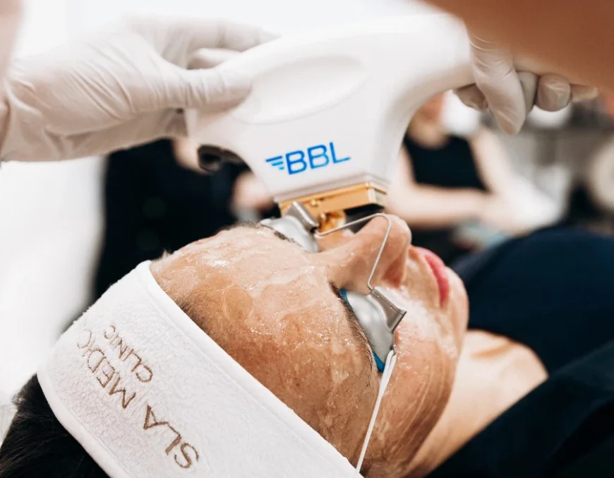 BBL Laser In Manchester – Advanced Skin Rejuvenation for a Youthful, Radiant Glow