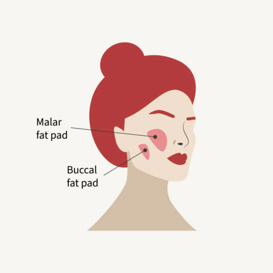 Buccal Fat Removal in Dubai: Achieve Slimmer Cheeks Fast