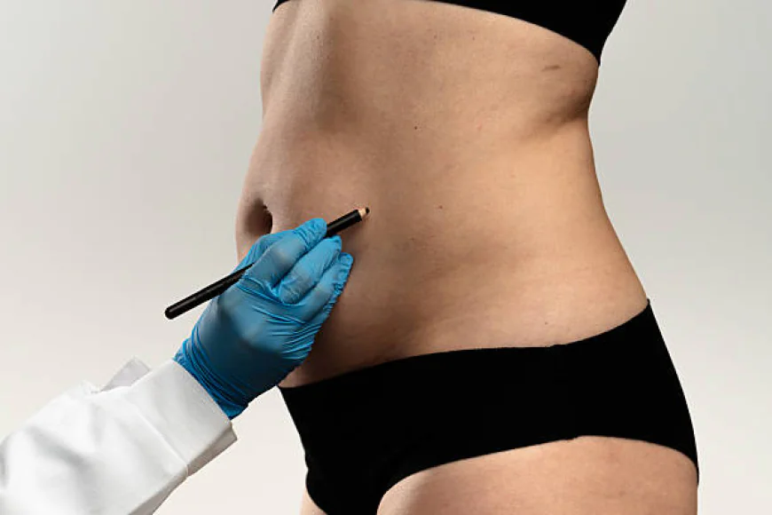 Liposuction in Dubai: Non-Surgical vs Surgical Options