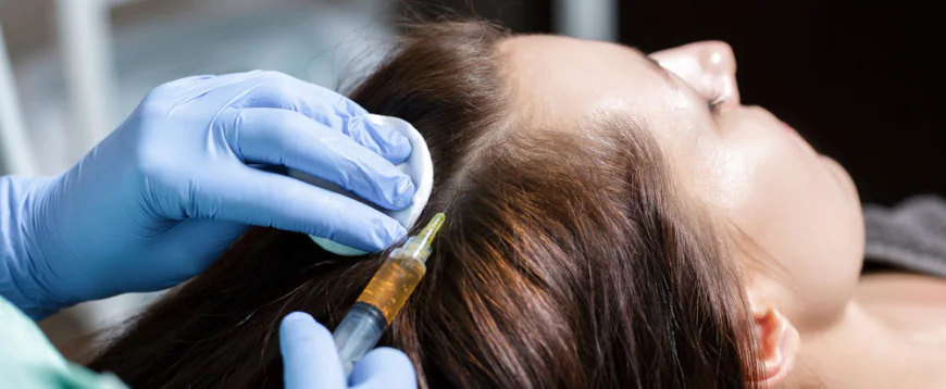 Boost Hair Density Smoothly With PRP Hair Treatment Cost Guidance
