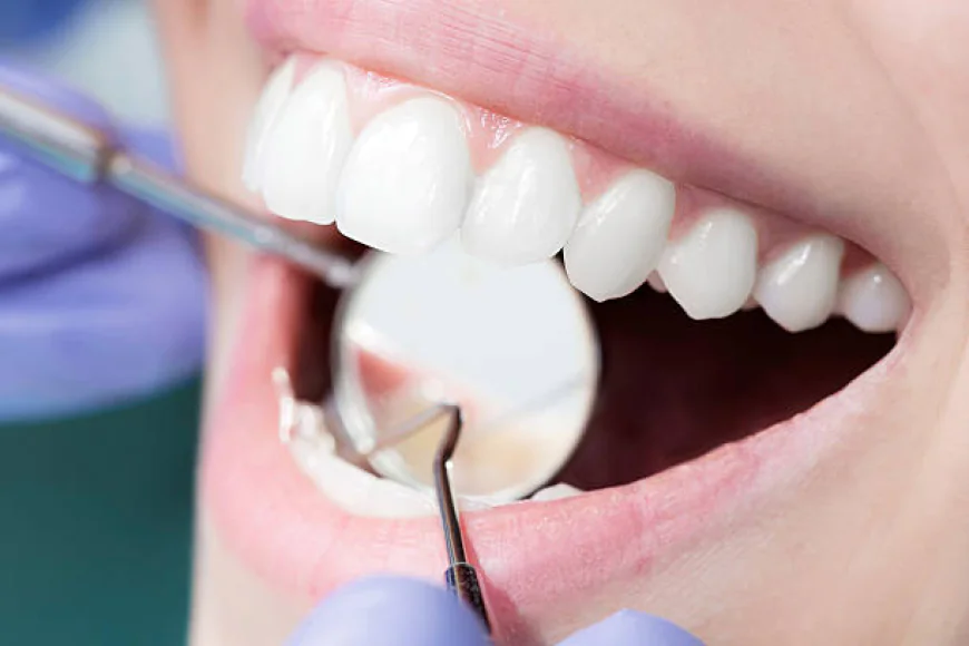 Dental Filling Price Questions Answered