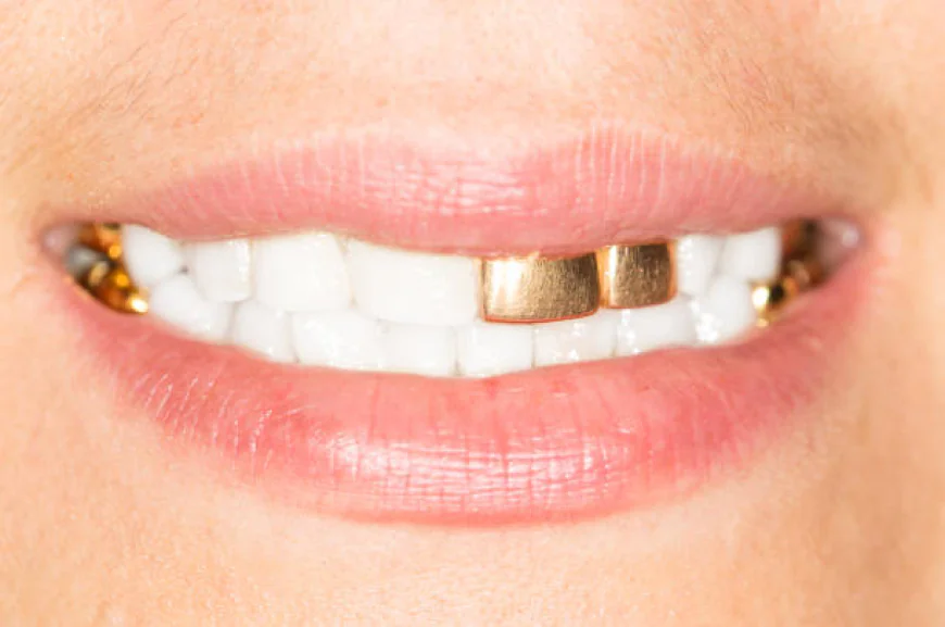 Gold Teeth: Luxury Meets Functionality