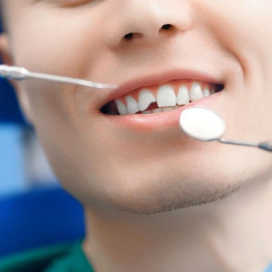 Tooth Fracture Treatment in Islamabad: Causes, Symptoms, and Solutions