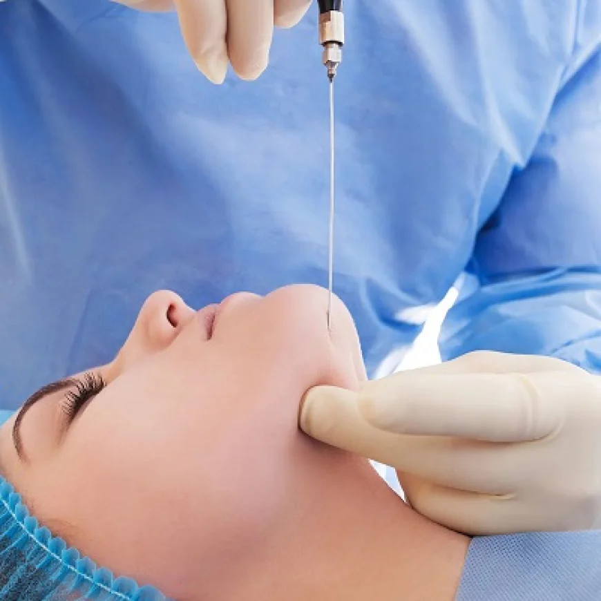 شفط دهون الذقن المزدوجة للحصول على صفاء وجه يدوم طويلاً