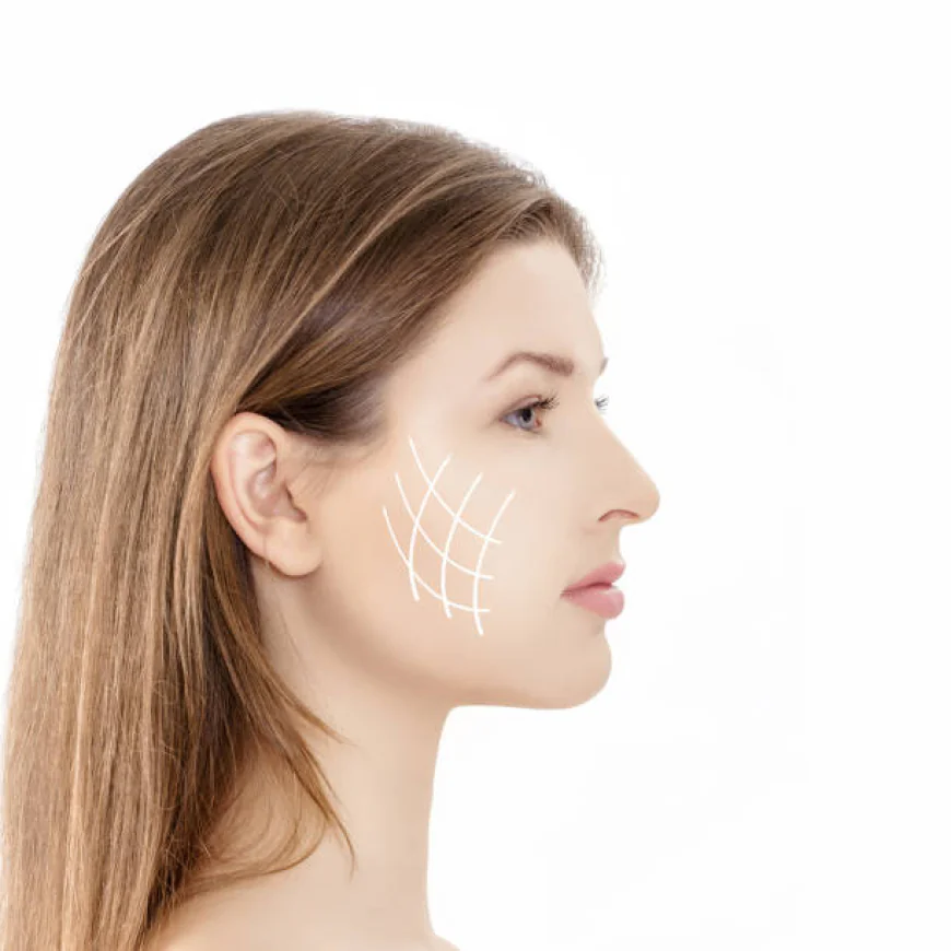 Silhouette Soft Thread Lift in Dubai: Non-Surgical Face Rejuvenation Guide