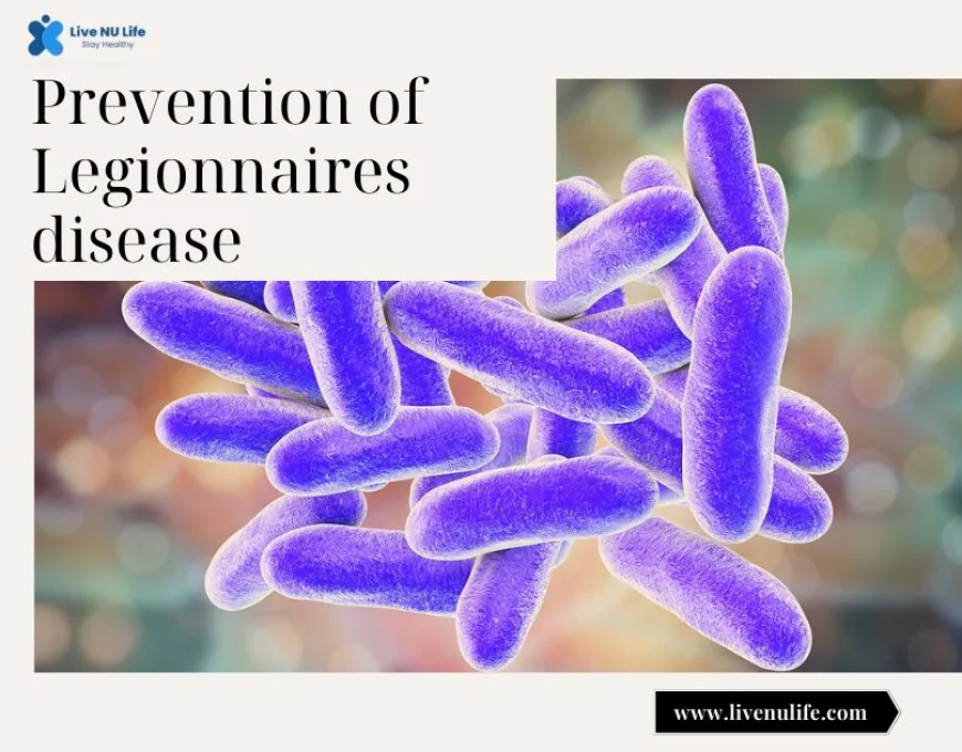 Prevention of Legionnaires Disease: How to Stay Safe from This Hidden Threat