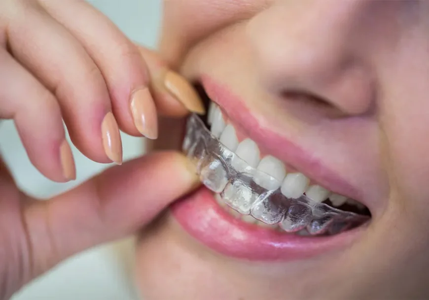 What Types of Braces Does an Orthodontist in Miramar, FL Offer?