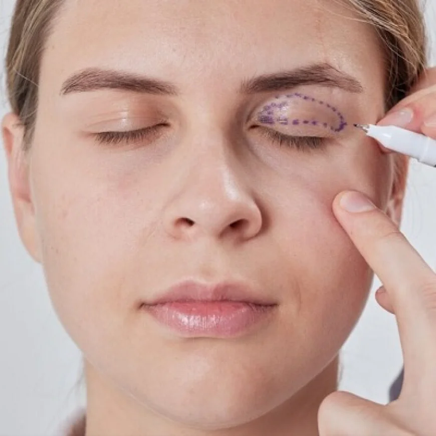 جراحة الجفن لعلاج انتفاخ العينين: نصائح الخبراء