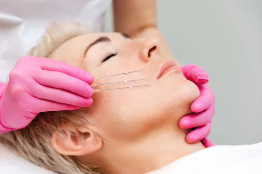The Non-Surgical Facelift: A Comprehensive Guide to PDO Threads Treatment in Islamabad