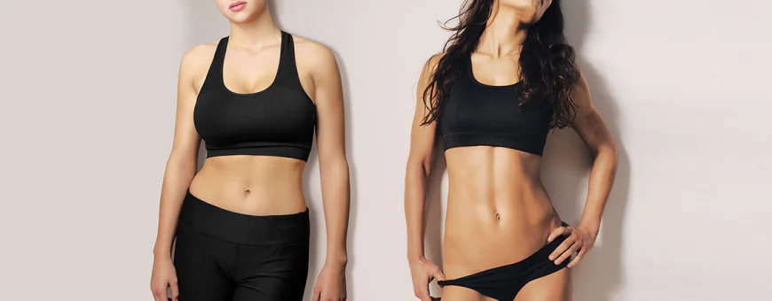 RG SHARP Technique for High-Definition Abdominoplasty