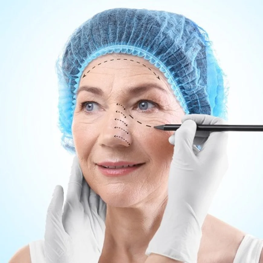 جراحة الجفن العلوي للحصول على مظهر شبابي