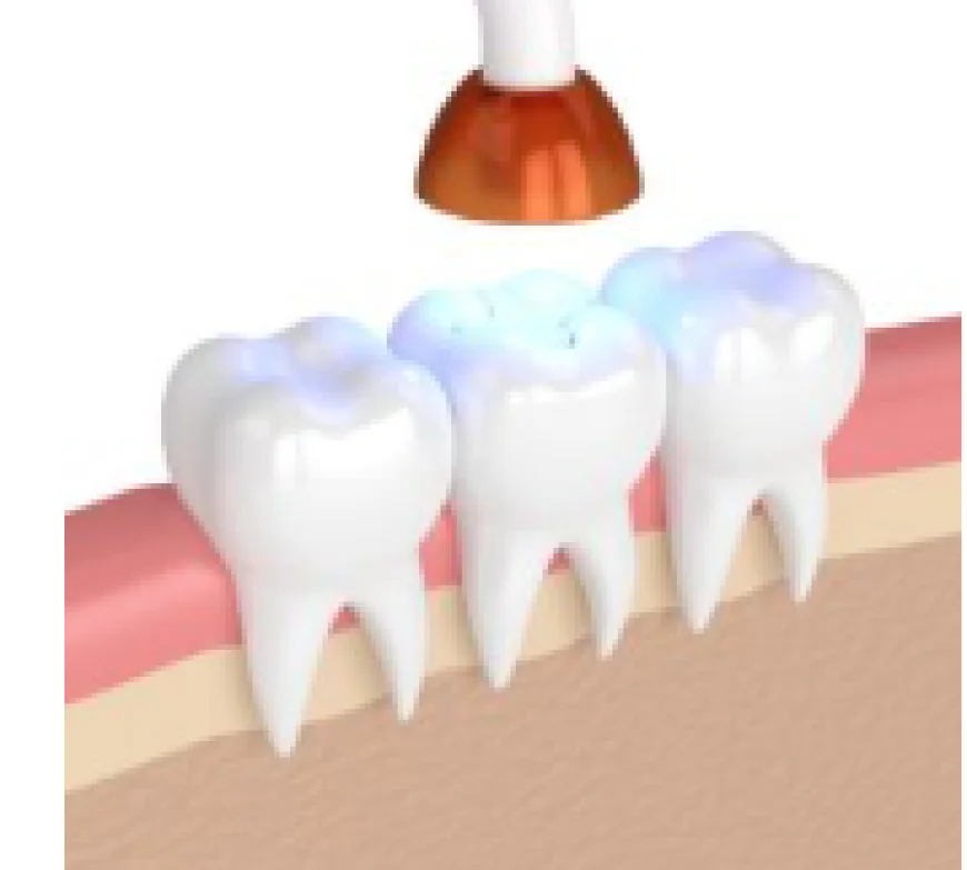 Holistic Dentist Santa Barbara: Natural & Comprehensive Dental Care