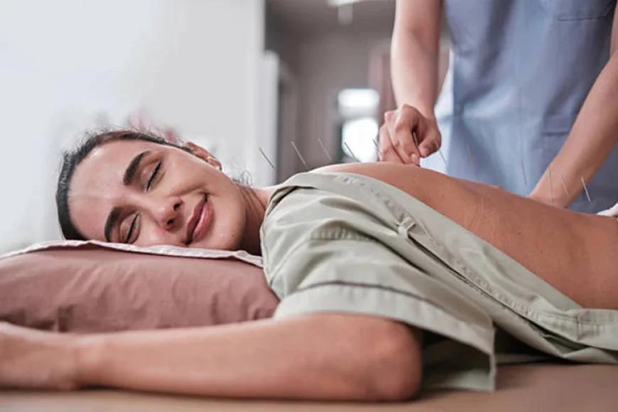 Feeling Stuck with PCOS Stress? How Acupuncture Could Help Reset Your Body