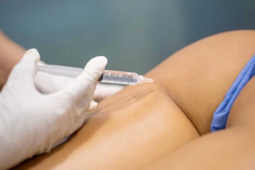 Buttock Augmentation: Full Breakdown