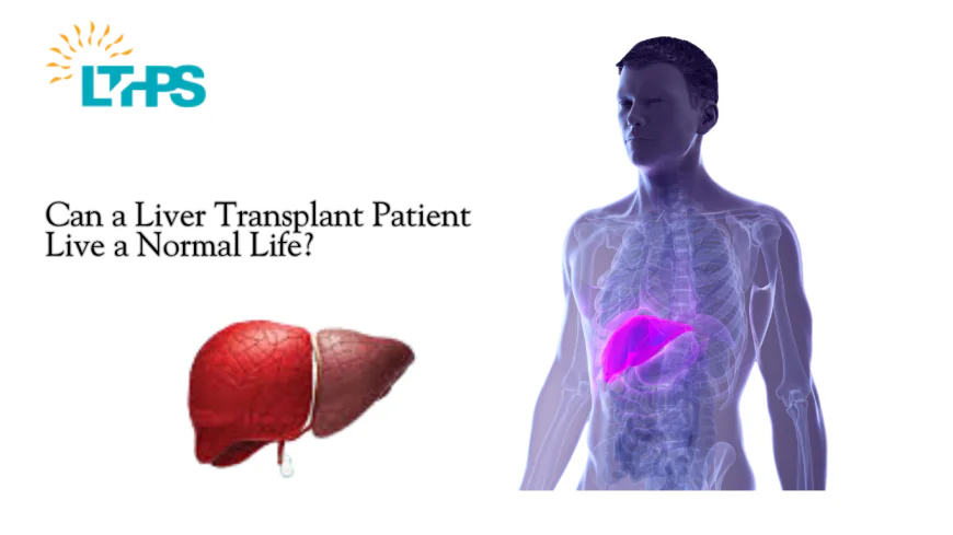 Can a Liver Transplant Patient Live a Normal Life?