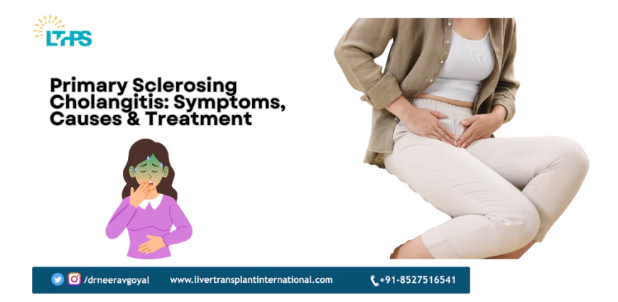 Primary Sclerosing Cholangitis: Symptoms, Causes & Treatment