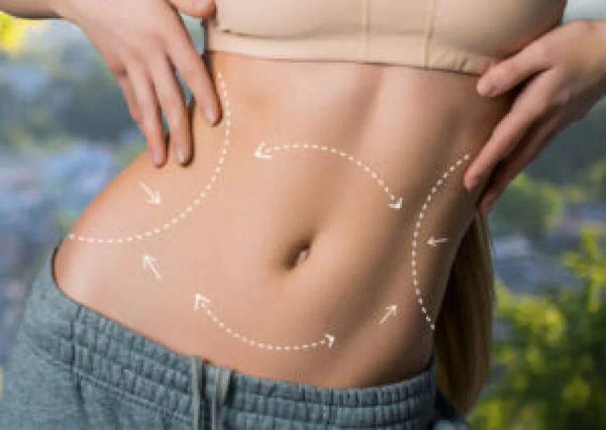 LIPOSUCTION SURGERY: Minimally Invasive Techniques for Faster Recovery