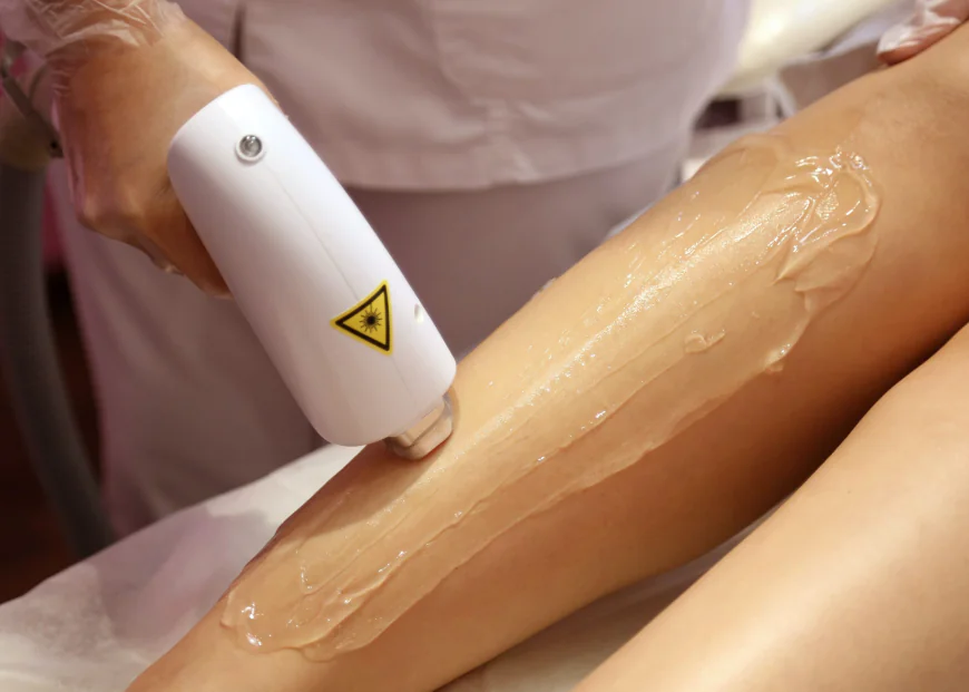 Laser Hair Removal Dubai: Benefits, Process & Results