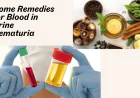 Home Remedies for Blood in Urine