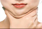 Double Chin Liposuction in Islamabad – Instant Confidence