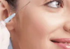 Top Questions About Dermal Fillers Injections Answered