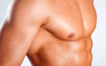 Gynecomastia Surgery FAQs: Honest Answers