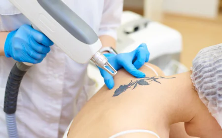 Tattoo Removal in Dubai: Minimizing Scars and Skin Damage
