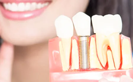 How do single tooth implants help preserve bone and improve oral function?
