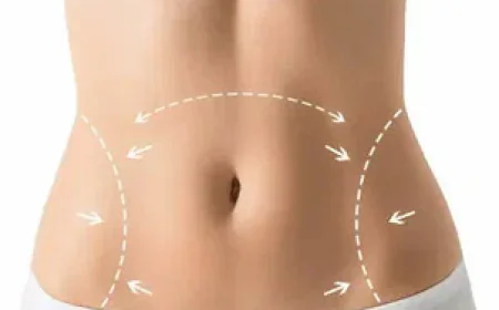 Abdominoplasty in Islamabad – Restore Your Body Shape