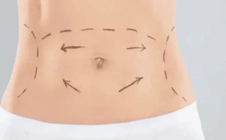 Tummy Tuck and Core Strength: What to Expect