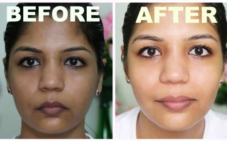 Does Glutathione Lighten Dark Spots? Everything You Need to Know About the Master Antioxidant