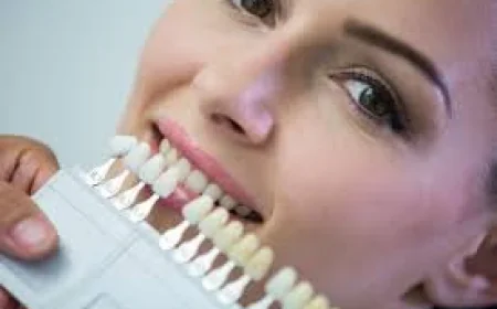 How Can You Safely Replace Multiple Teeth at Once?